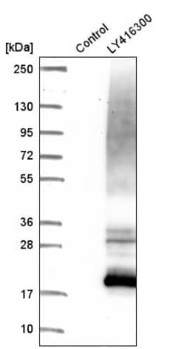 Uroplakin Ib Antibody, Novus Biologicals 0.1mL; Unlabeled:Antibodies, Polyclonal